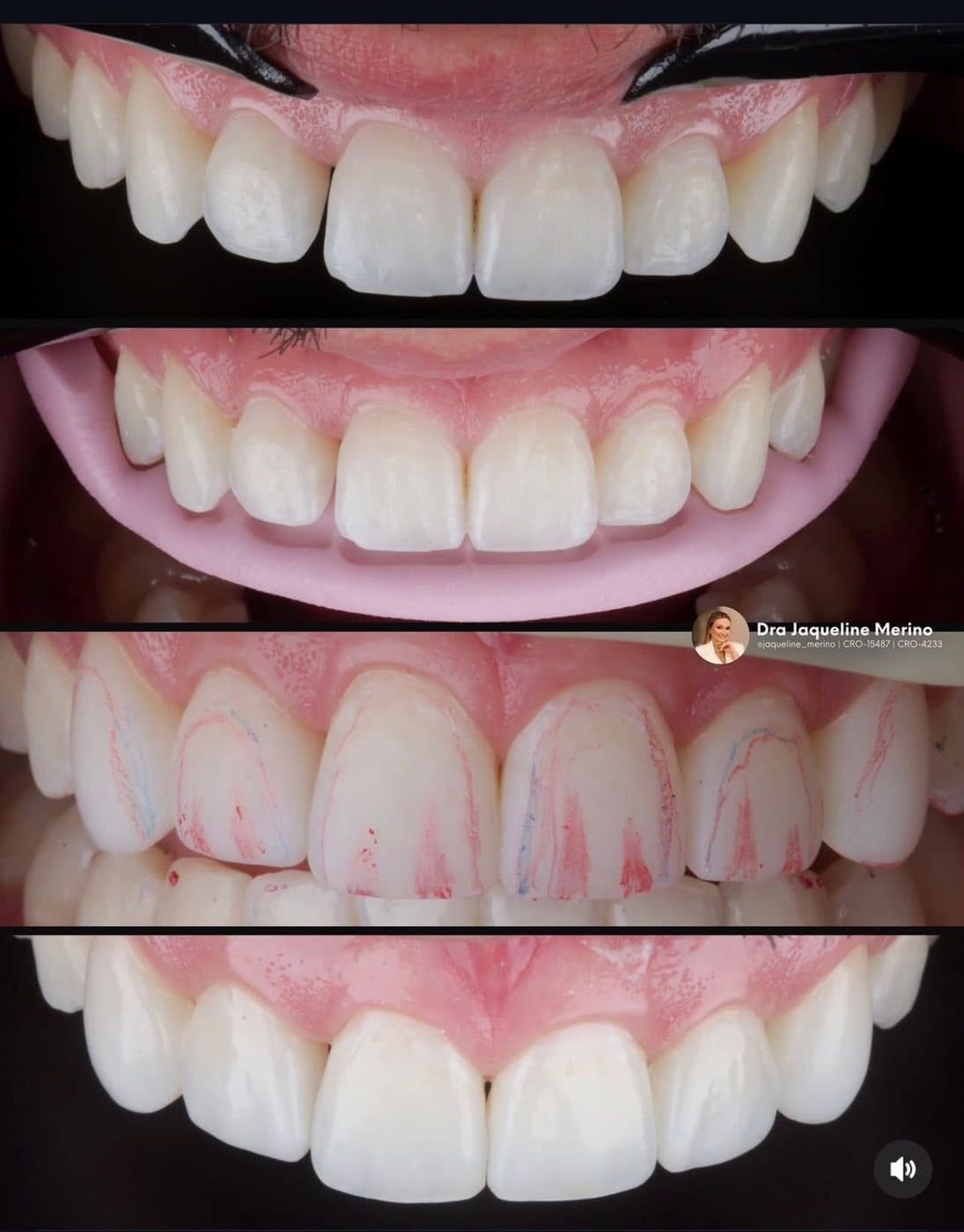 Clinical photograph by Dr. Jaqueline Amadeu Merino