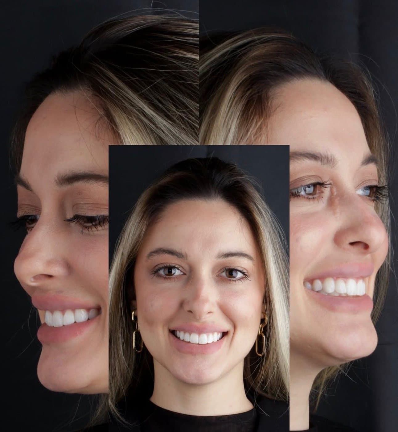 Clinical photograph by Dr. Jaqueline Amadeu Merino