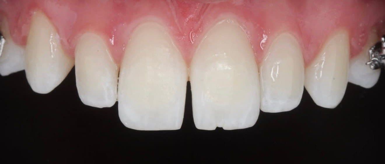 Clinical case 2 by Dr. Jaqueline Amadeu Merino — Before